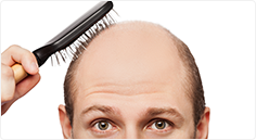 Det finns läkemedel som stoppar ytterligare håravfall